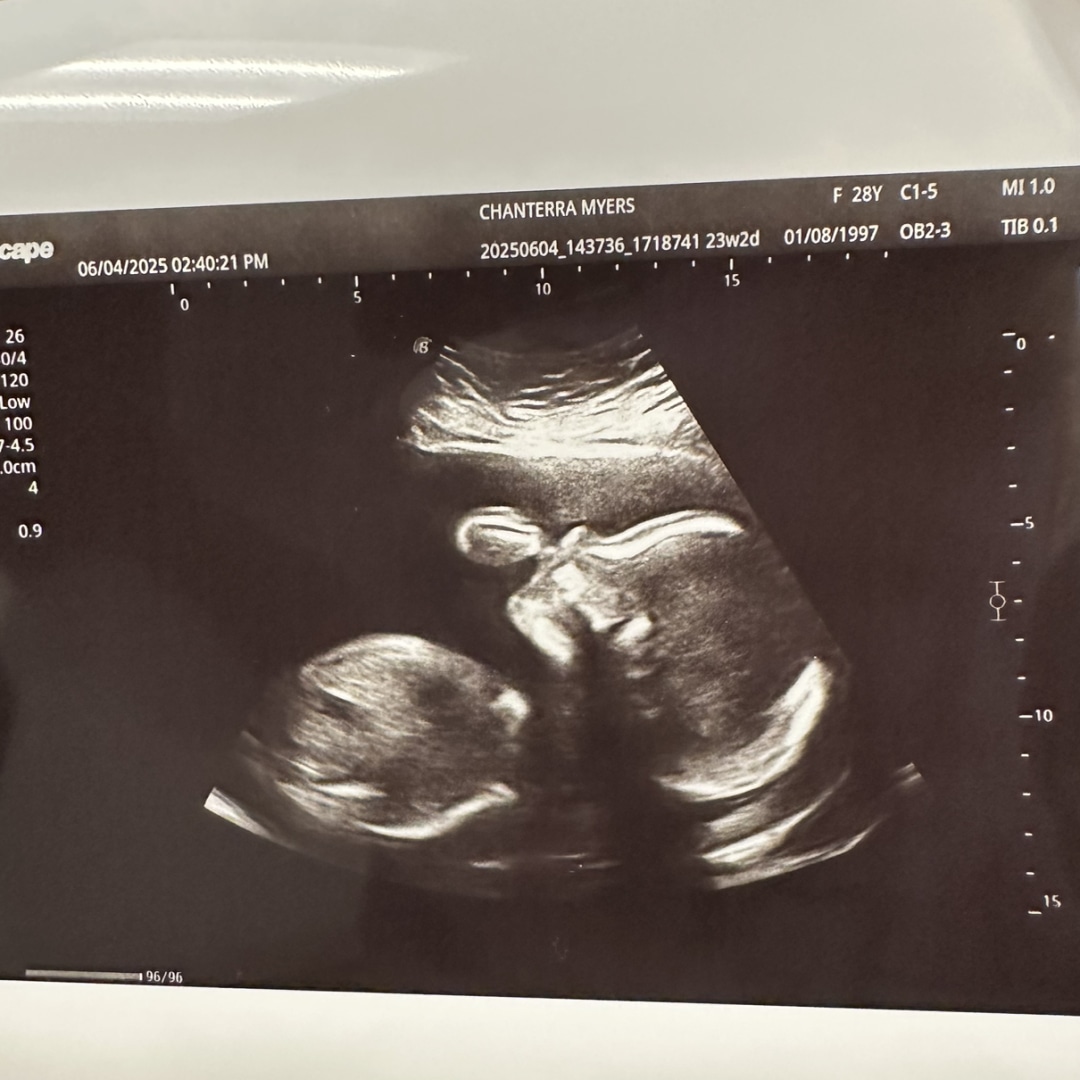 Photo shared by Chanterra for their Babylist baby registry.