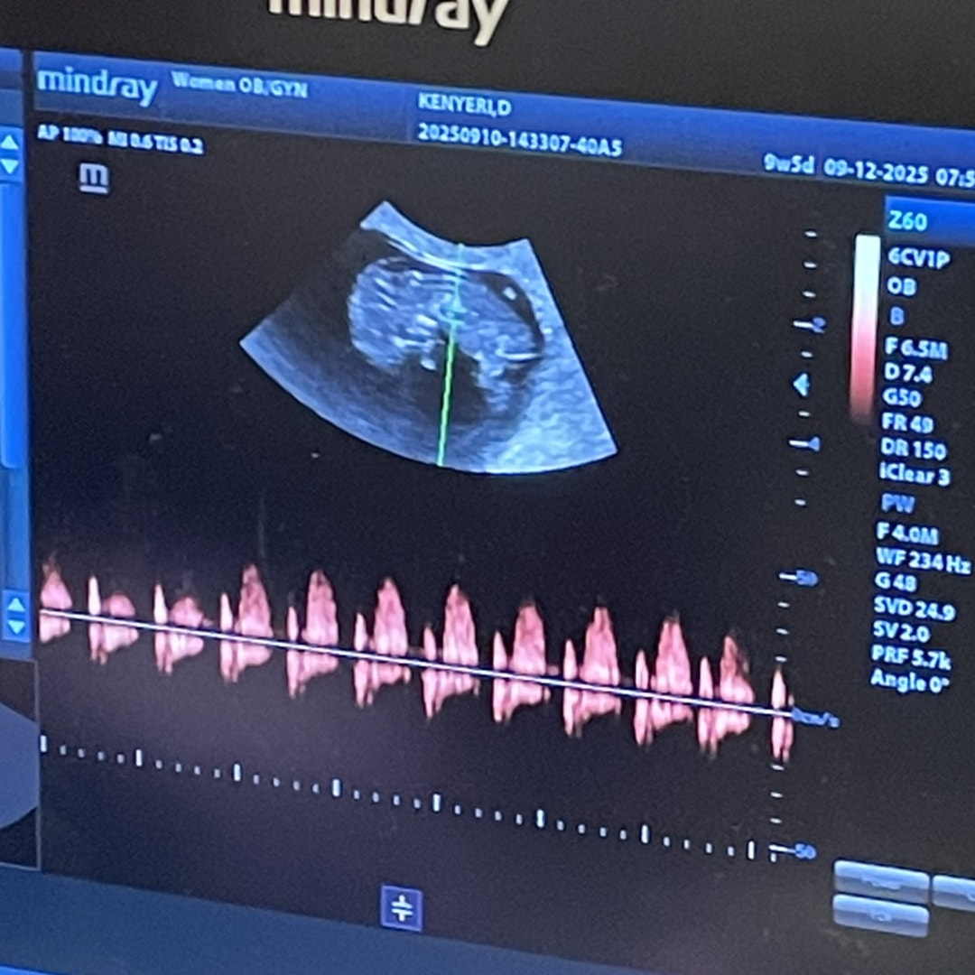 Photo shared by Danielle for their Babylist baby registry.