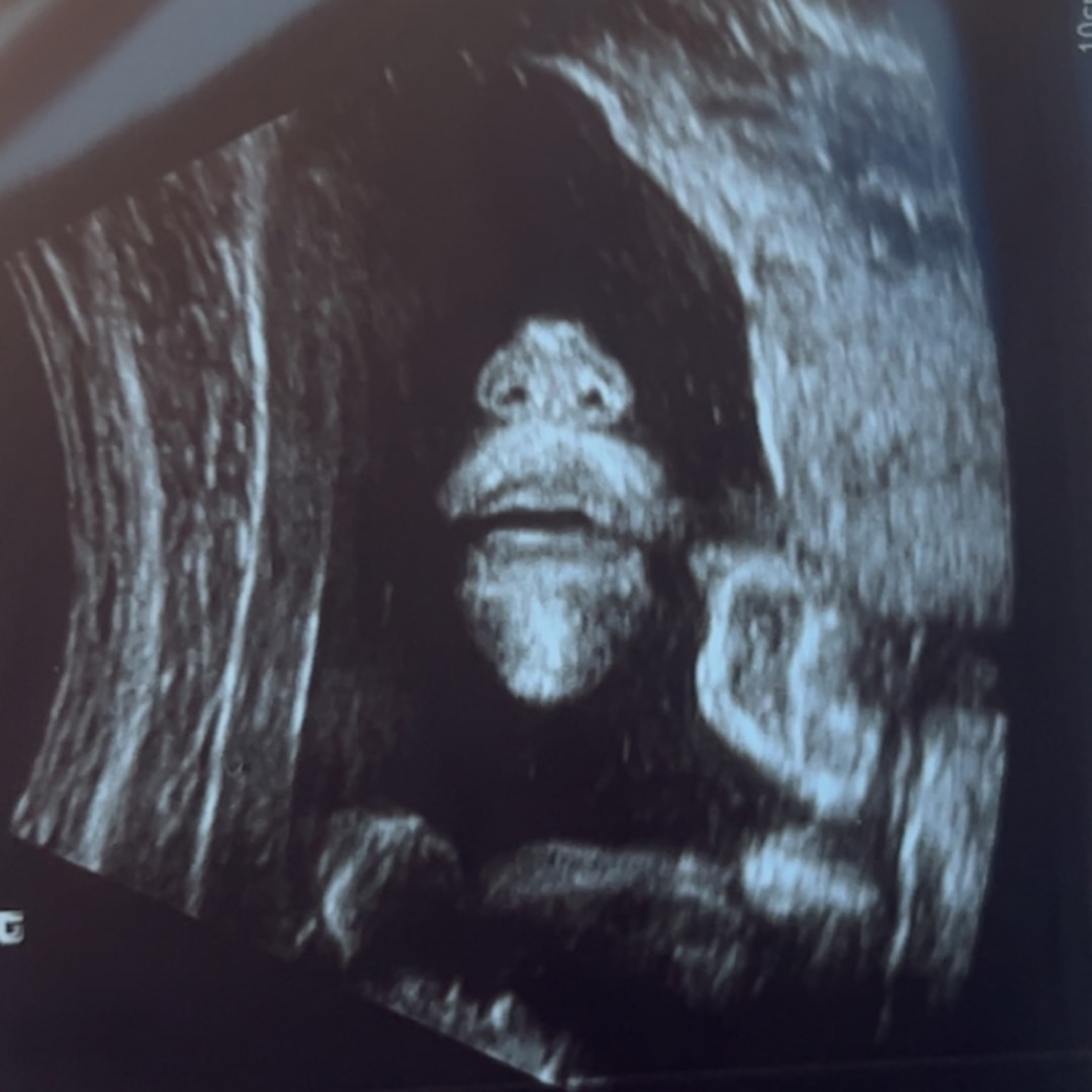 Photo shared by Kaleigh for their Babylist baby registry.