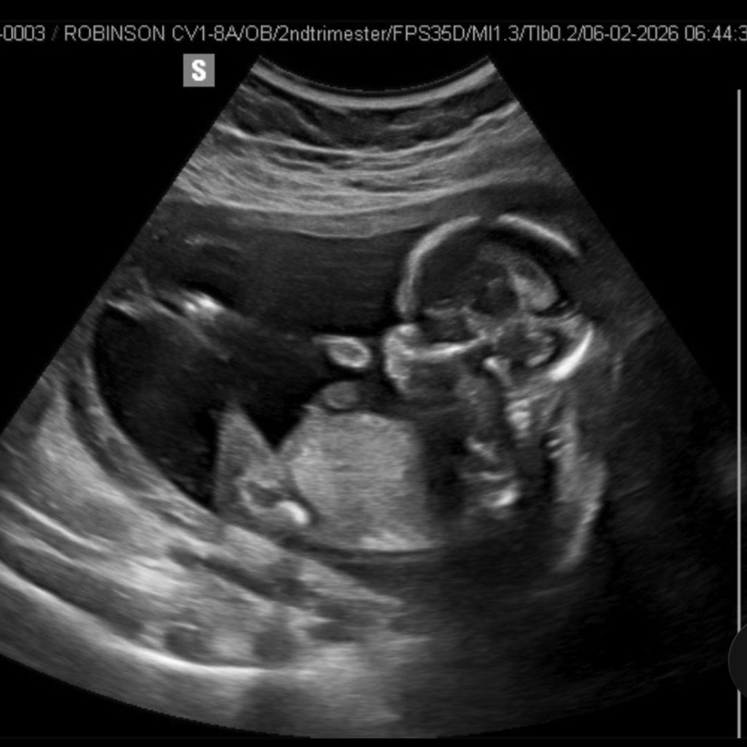 Photo shared by Caitlyn for their Babylist baby registry.