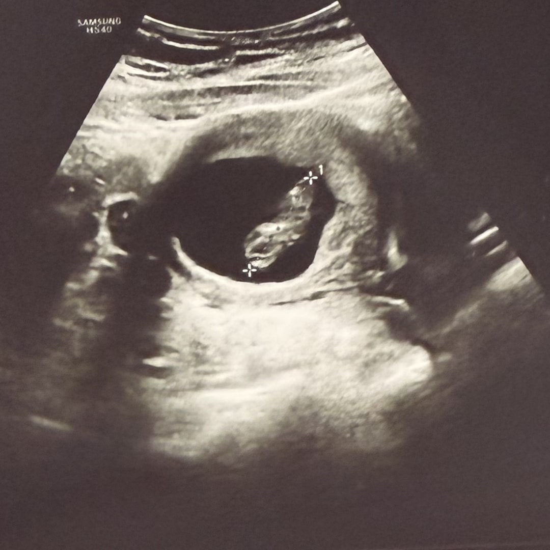 Photo shared by Shanthornie for their Babylist baby registry.