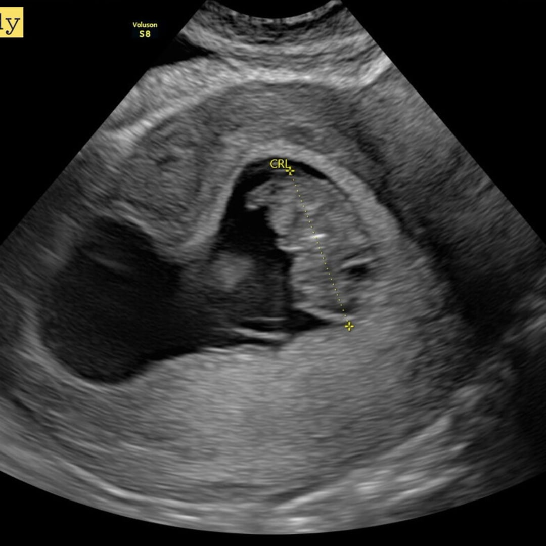 Photo shared by Joy for their Babylist baby registry.