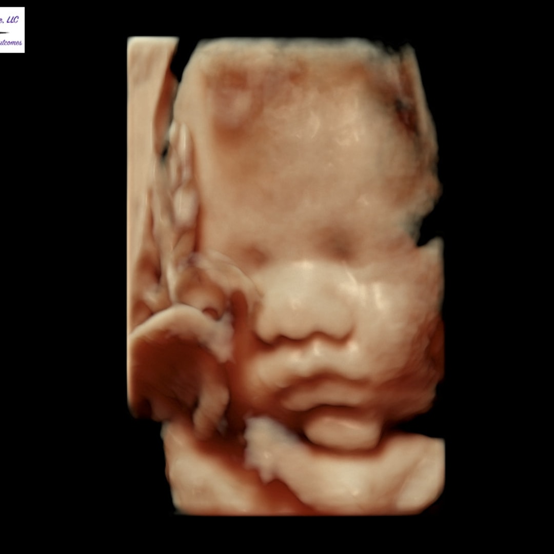 Photo shared by Emma for their Babylist baby registry.