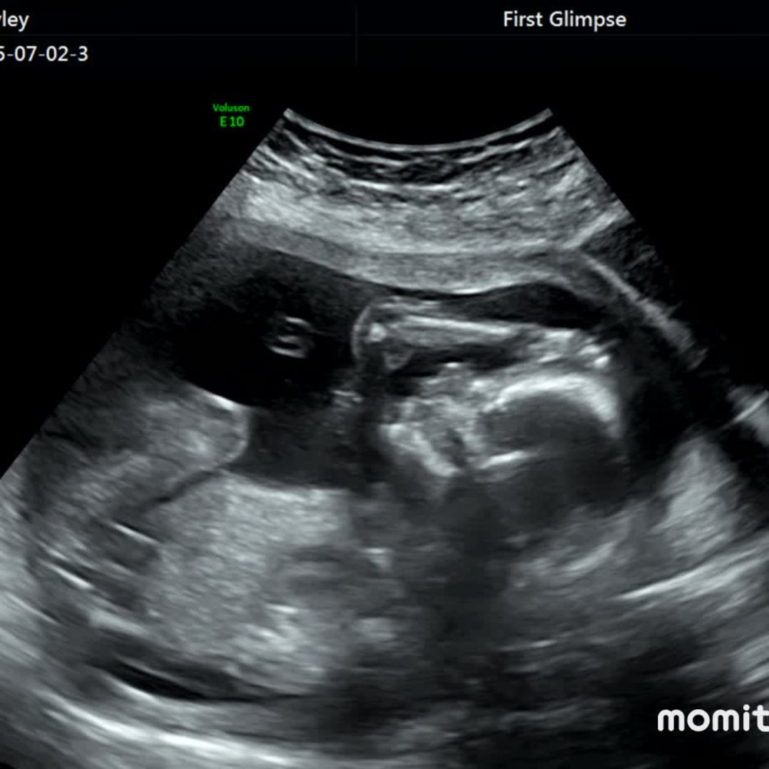 Photo shared by Kayley for their Babylist baby registry.
