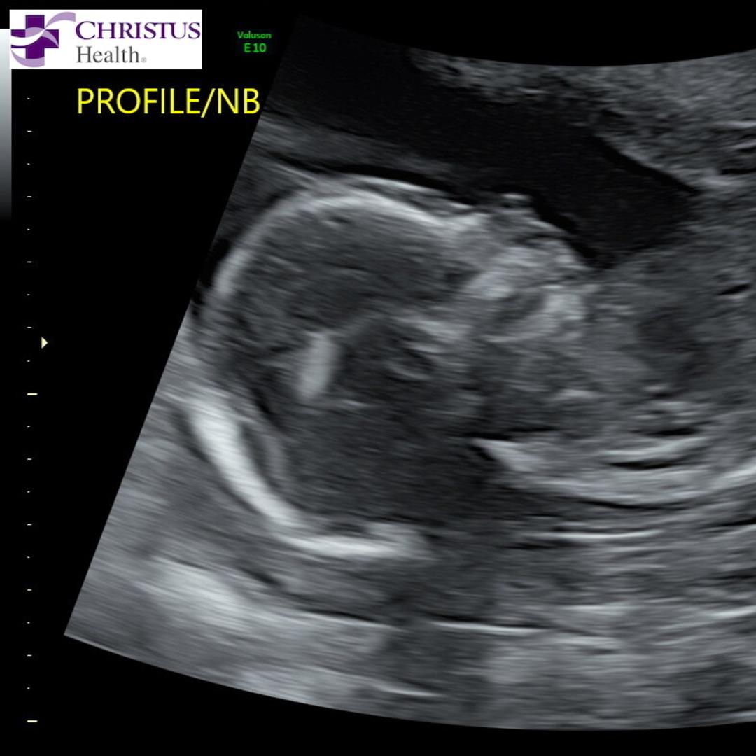 Photo shared by Bethany for their Babylist baby registry.