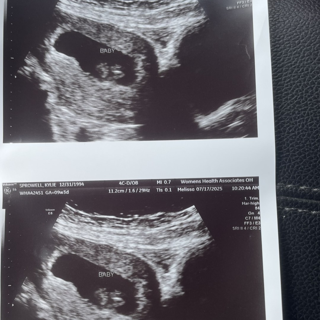 Photo shared by Kylie for their Babylist baby registry.