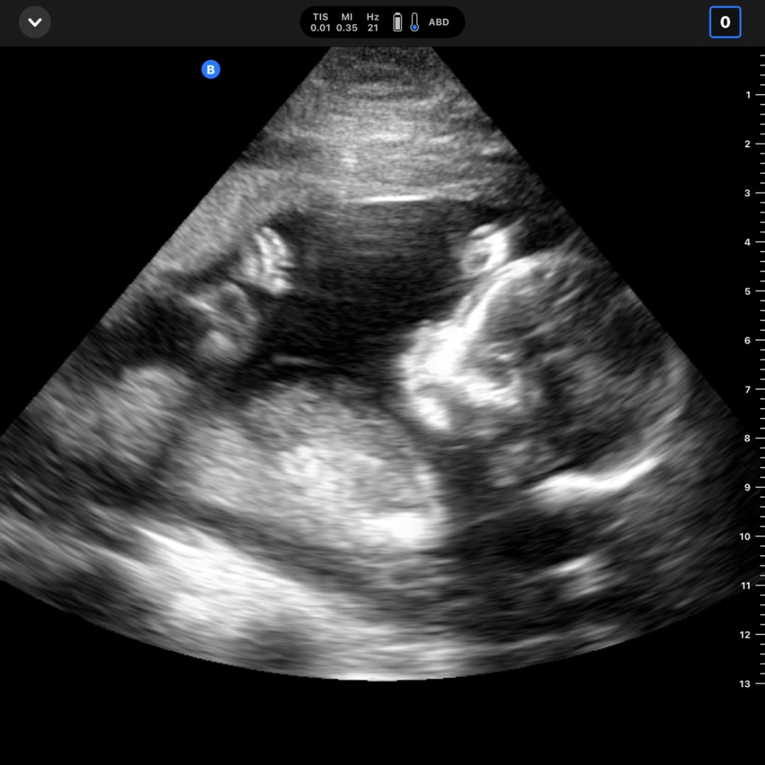 Photo shared by Natalie for their Babylist baby registry.