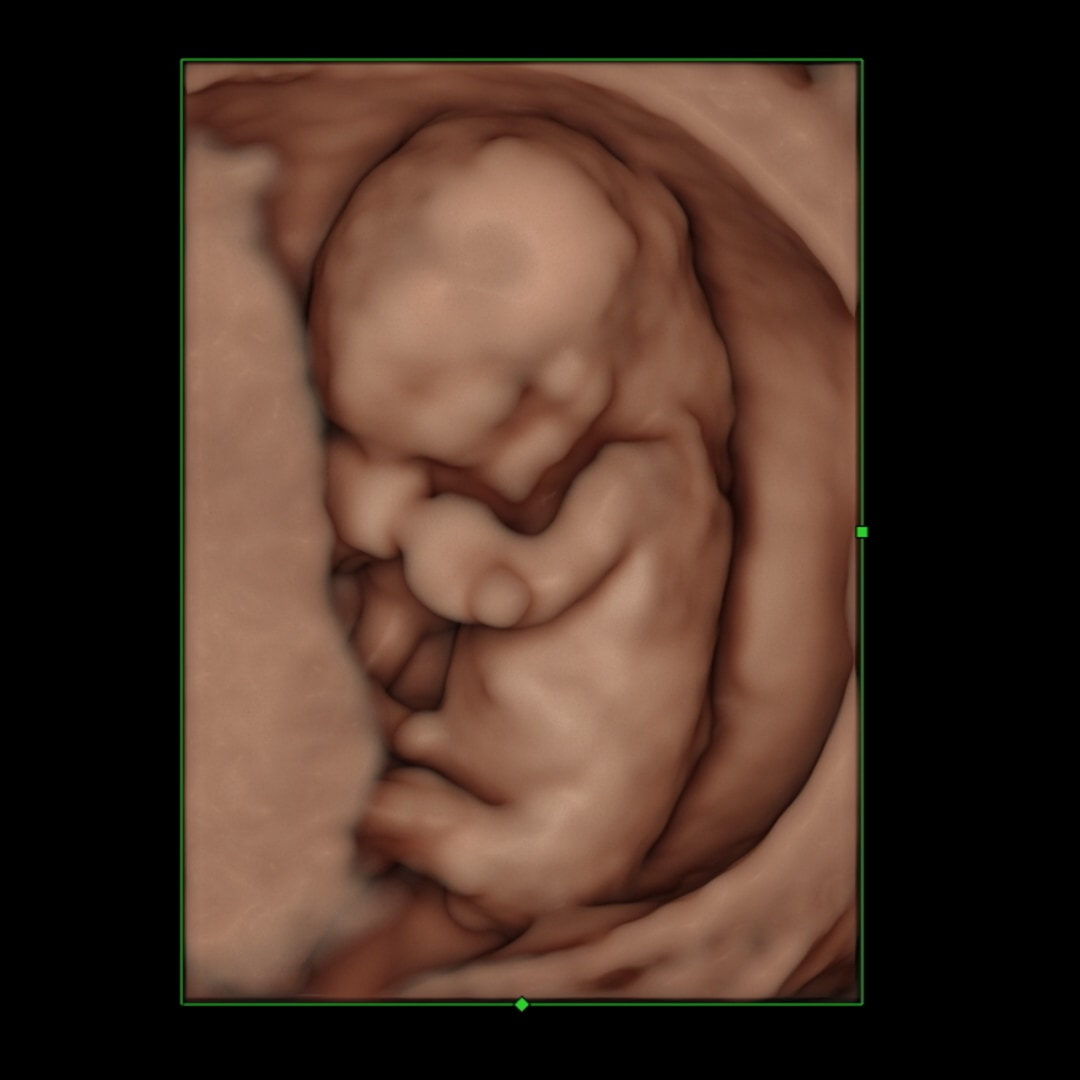 Photo shared by Catherin for their Babylist baby registry.
