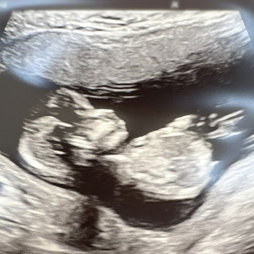Photo shared by Kristin for their Babylist baby registry.