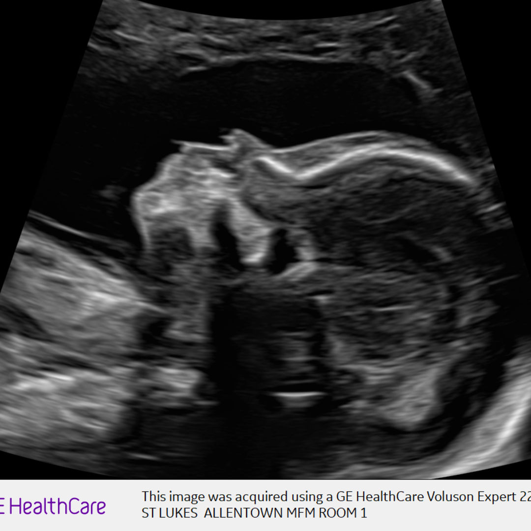 Photo shared by Melbaliz for their Babylist baby registry.