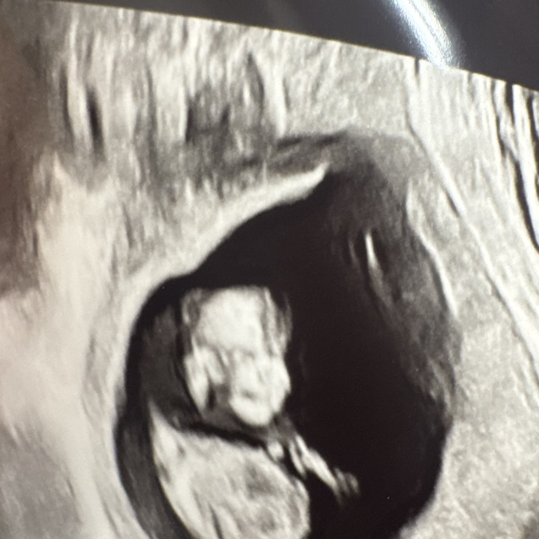 Photo shared by Cathy for their Babylist baby registry.