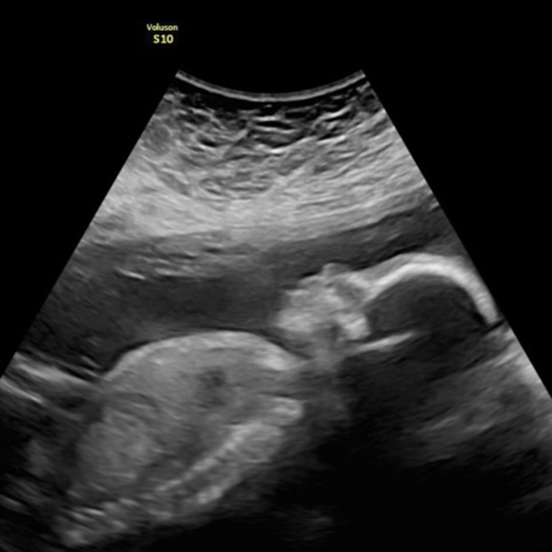 Photo shared by Rebecca for their Babylist baby registry.