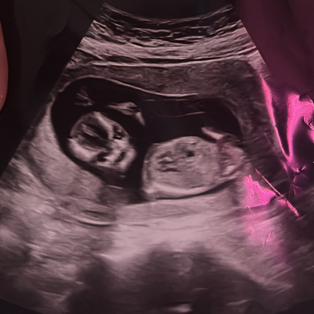 Photo shared by Amithyst for their Babylist baby registry.