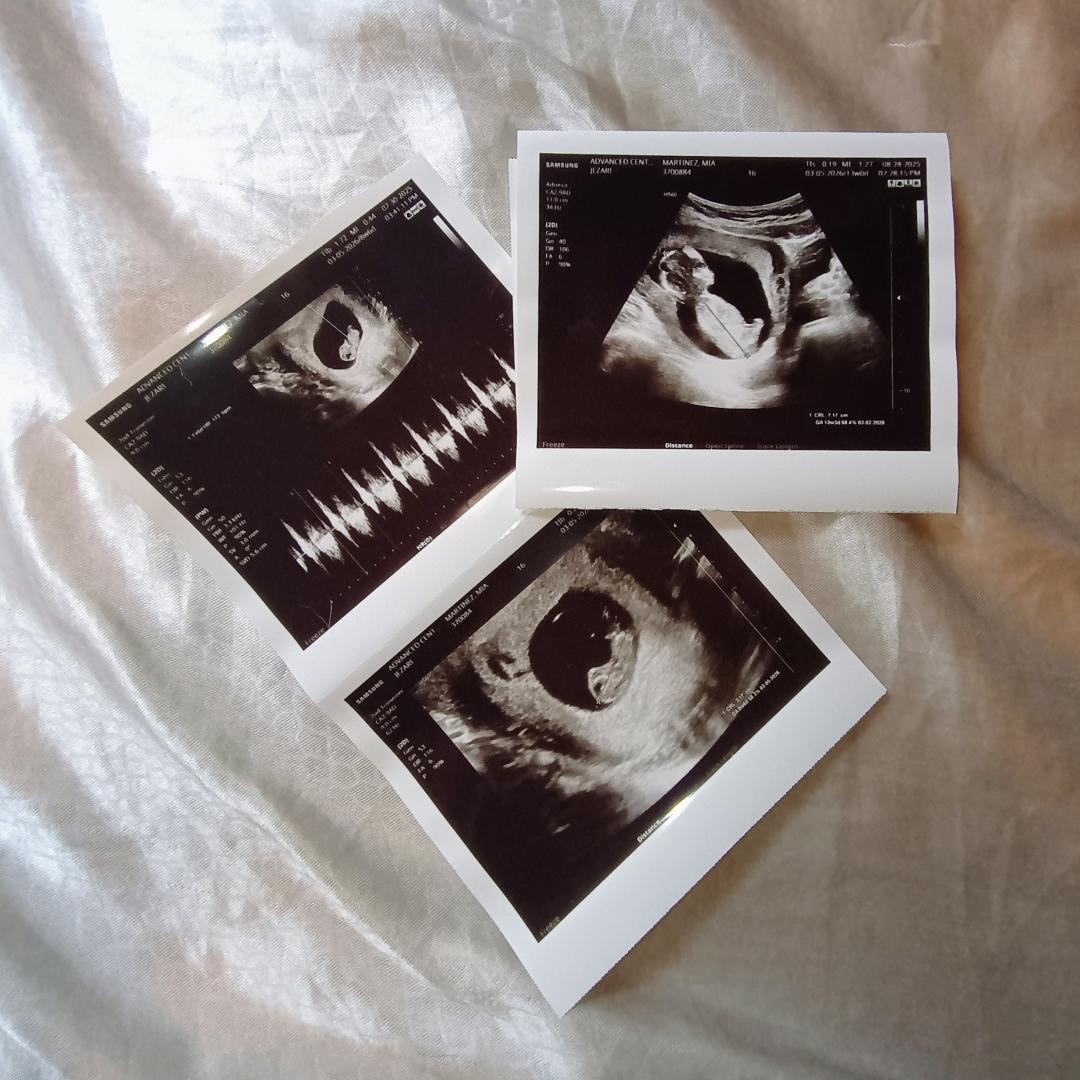 Photo shared by Mia for their Babylist baby registry.