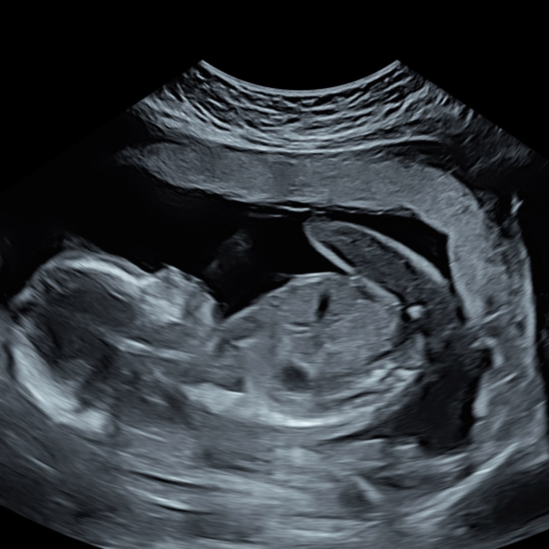 Photo shared by Grace for their Babylist baby registry.