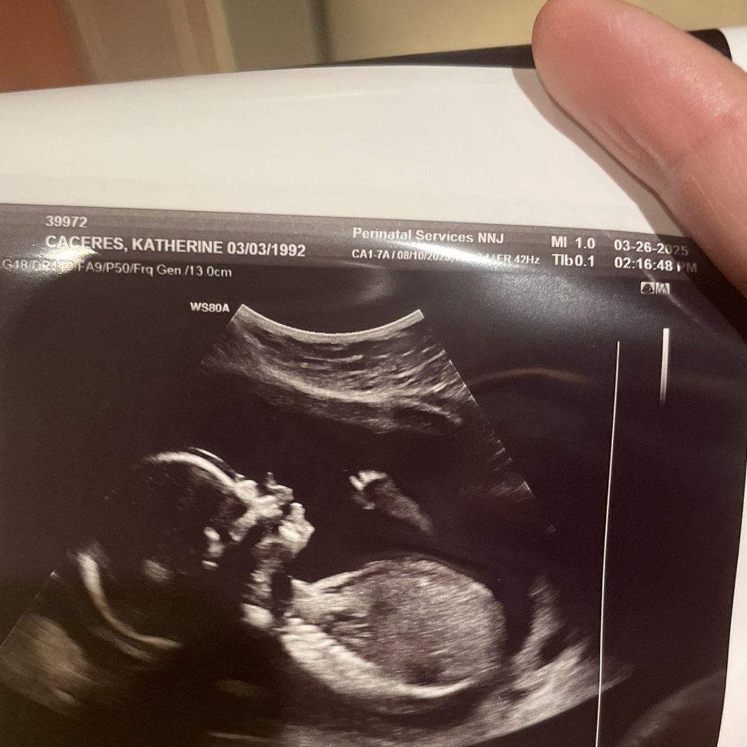 Photo shared by Katherine for their Babylist baby registry.