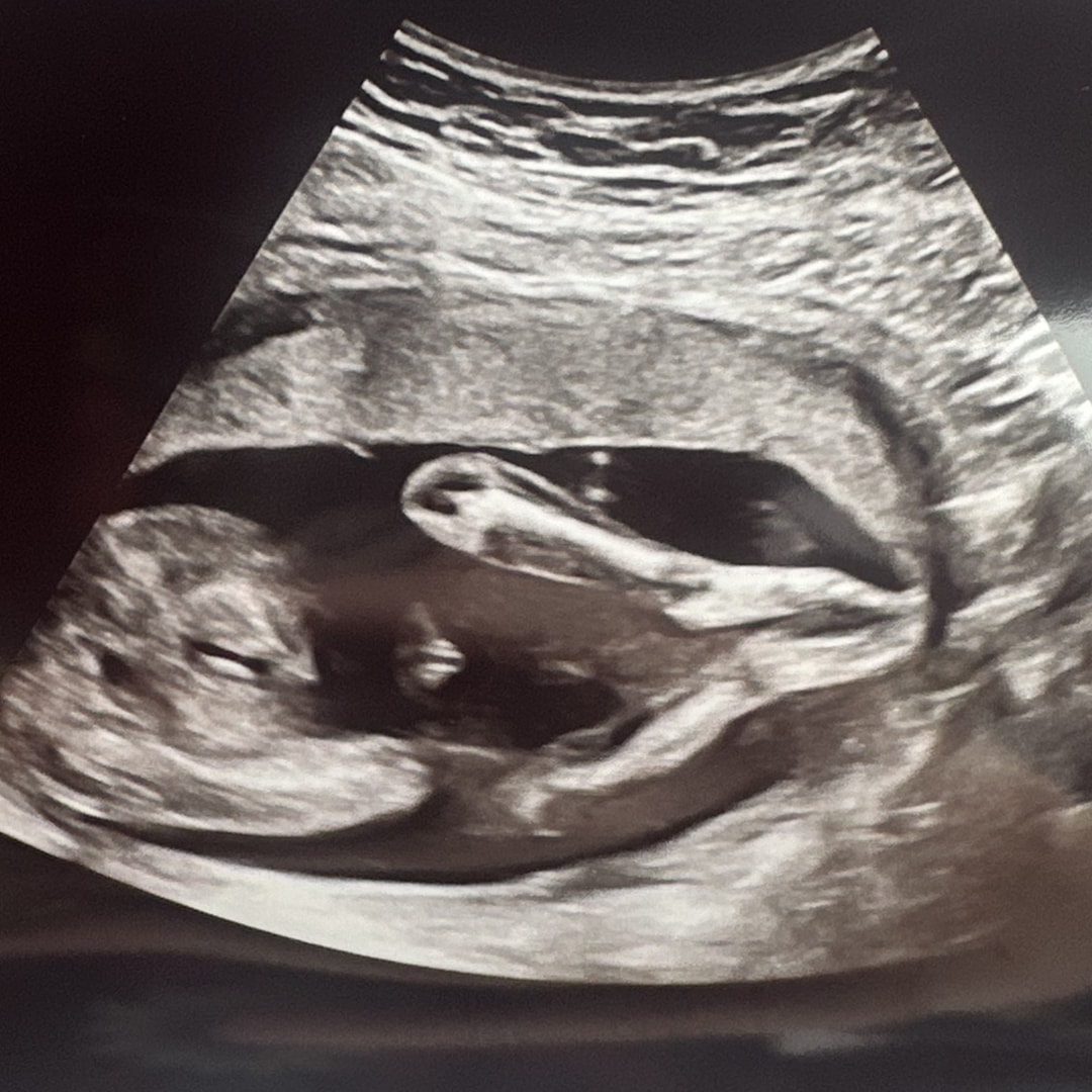 Photo shared by Keara for their Babylist baby registry.