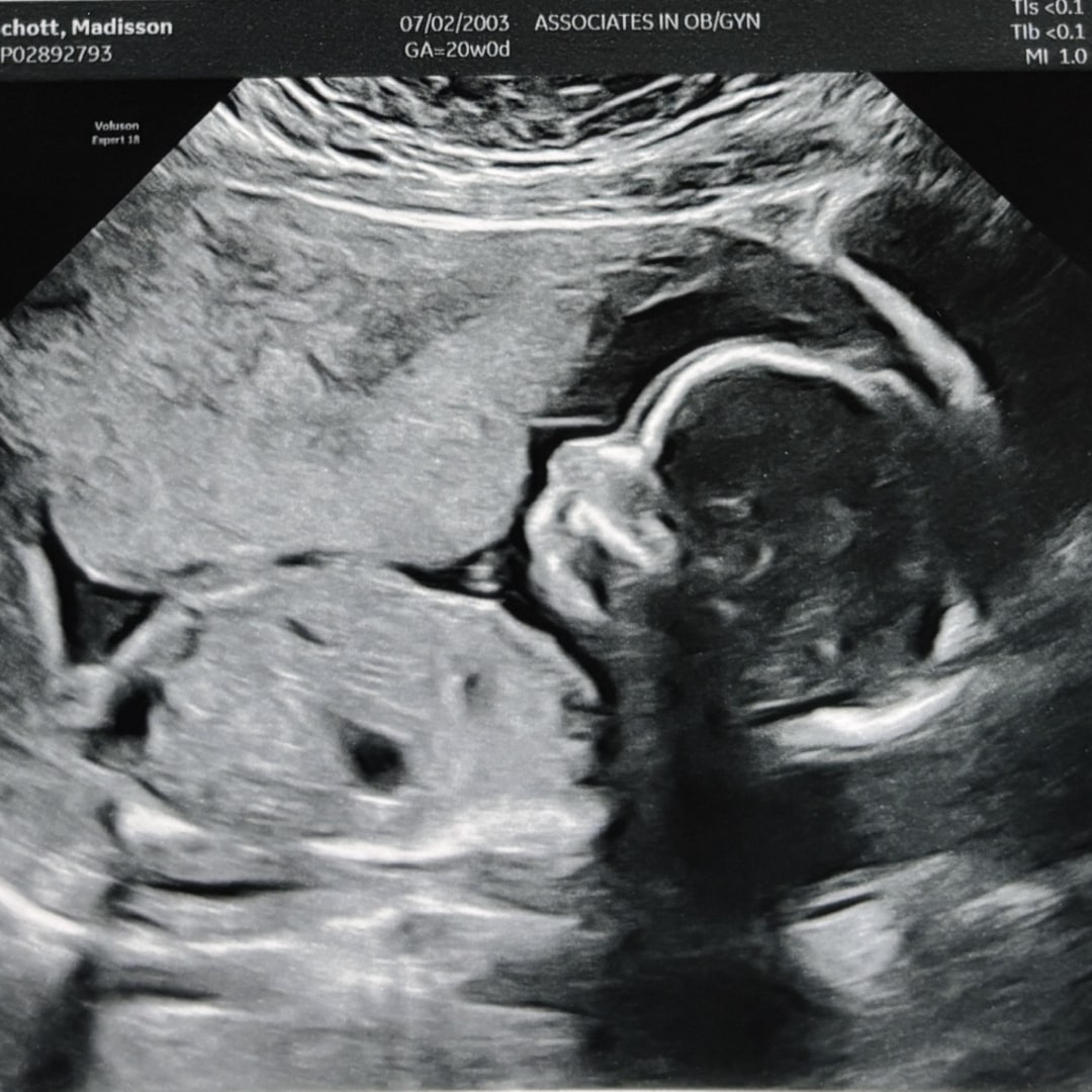 Photo shared by Madisson for their Babylist baby registry.