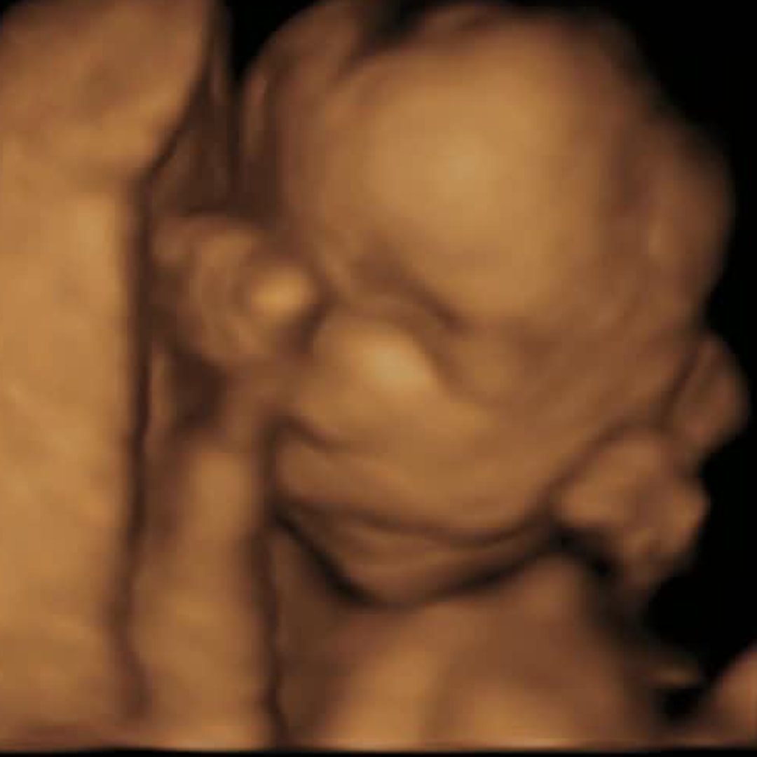 Photo shared by Anna for their Babylist baby registry.