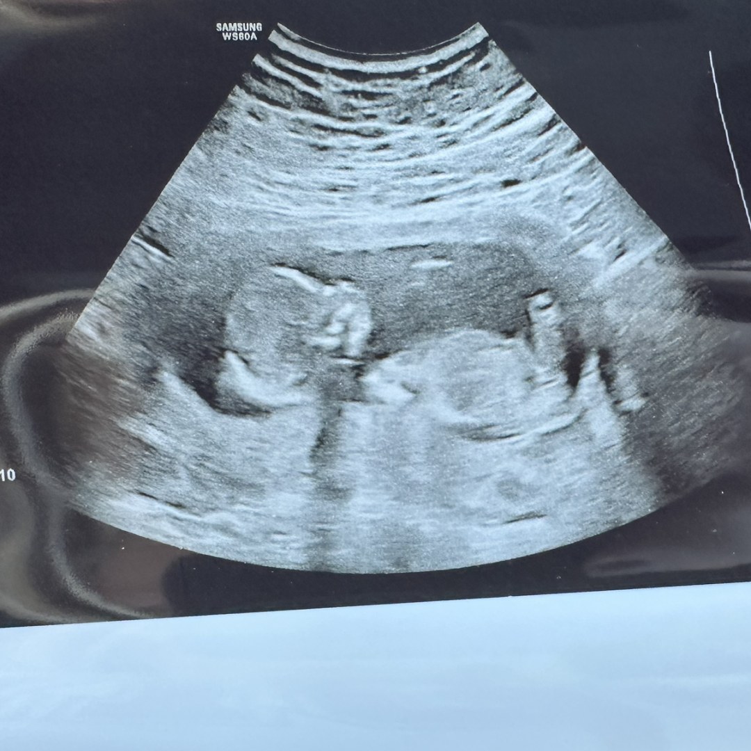 Photo shared by Jordan for their Babylist baby registry.