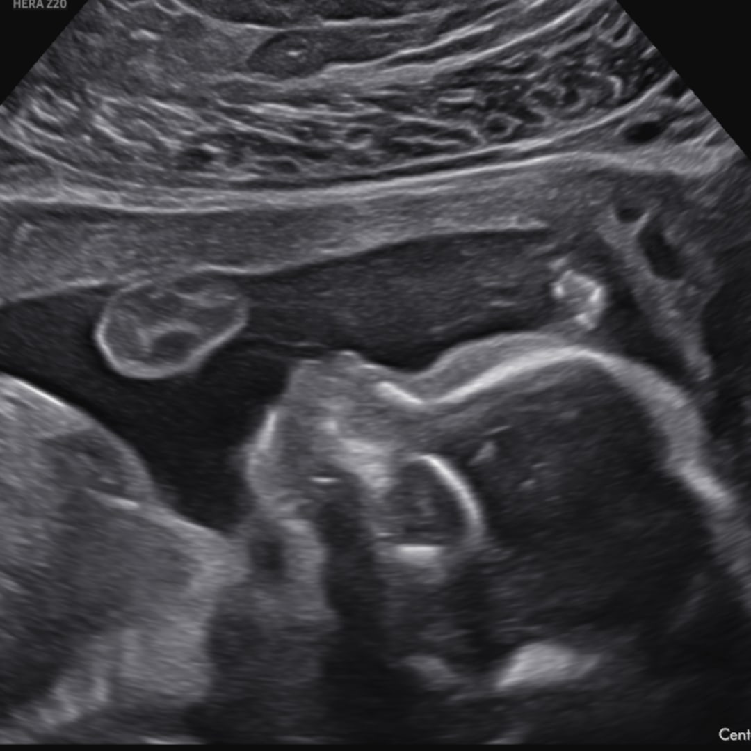 Photo shared by Danielle for their Babylist baby registry.