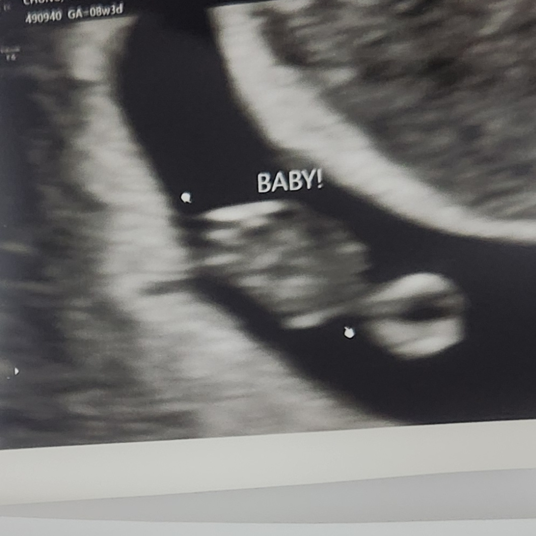 Photo shared by Yenny for their Babylist baby registry.