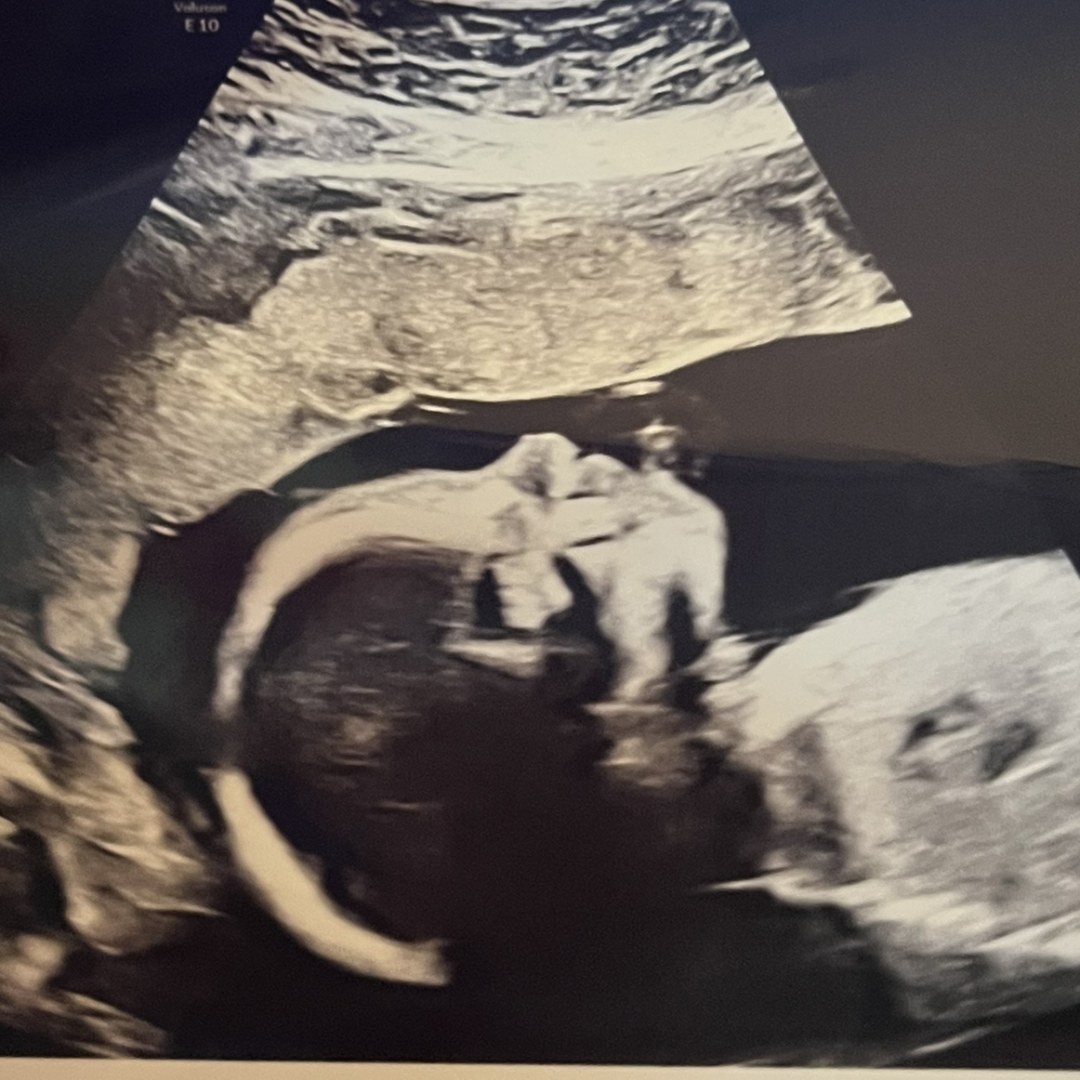 Photo shared by Kinsasha for their Babylist baby registry.