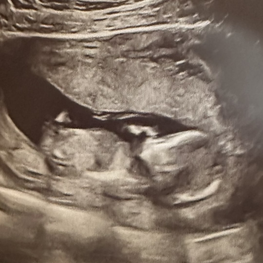 Photo shared by Melanie for their Babylist baby registry.