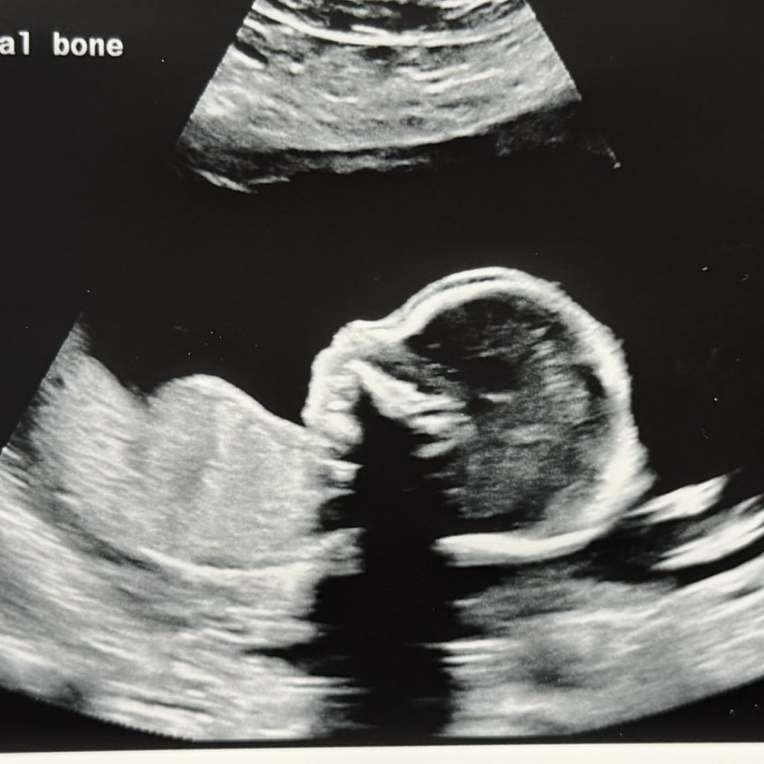 Photo shared by Nhilze for their Babylist baby registry.