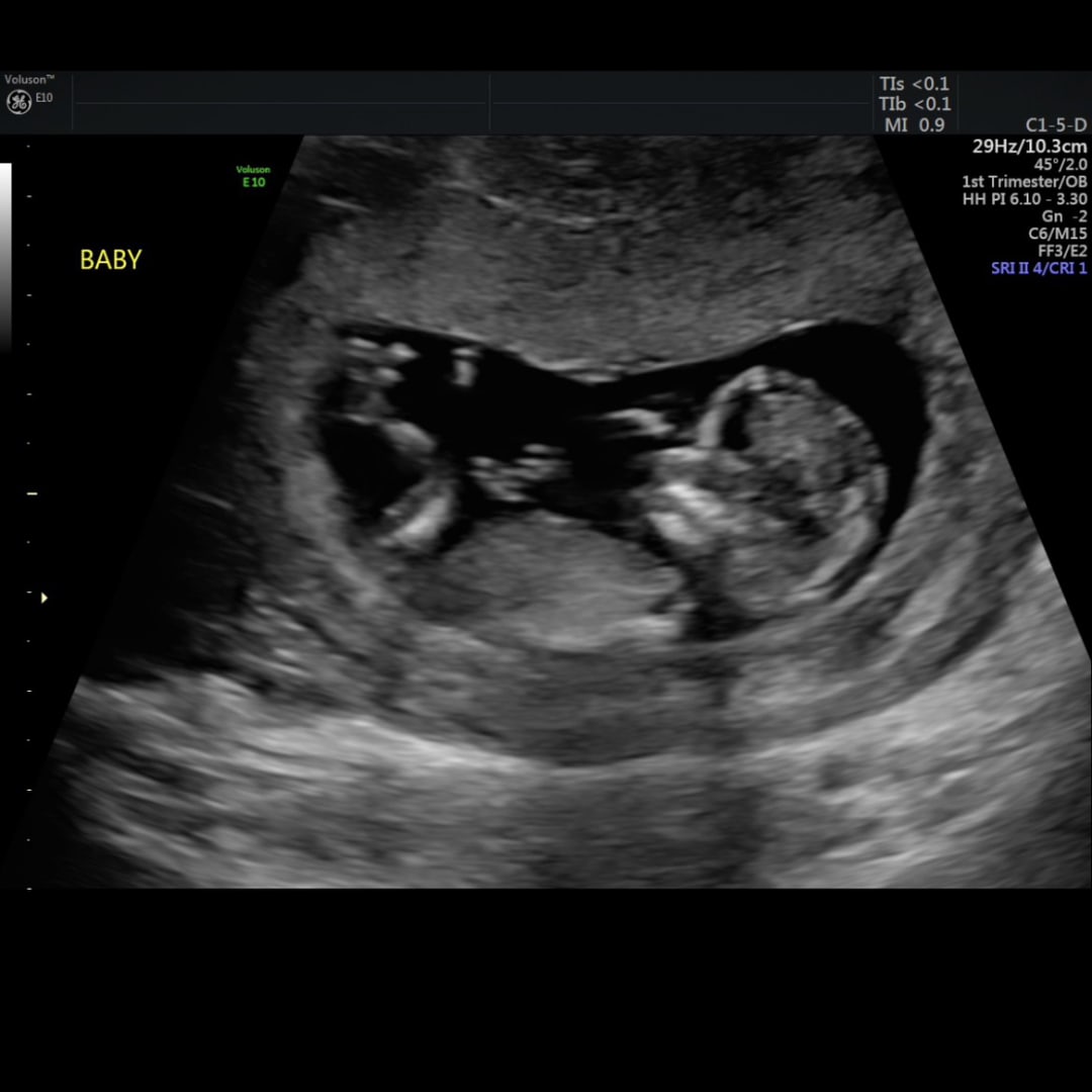 Photo shared by Eden for their Babylist baby registry.
