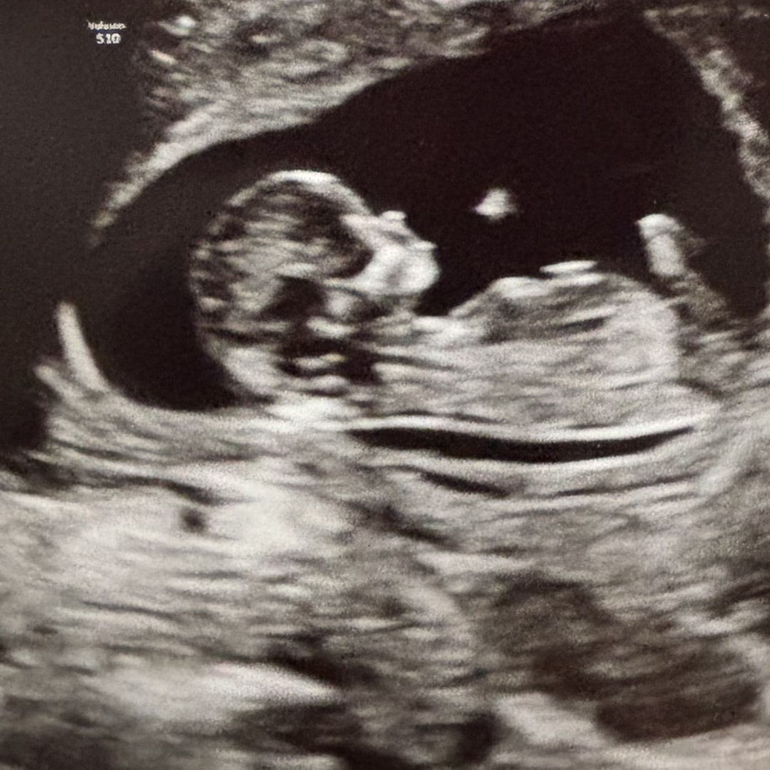 Photo shared by Haley for their Babylist baby registry.