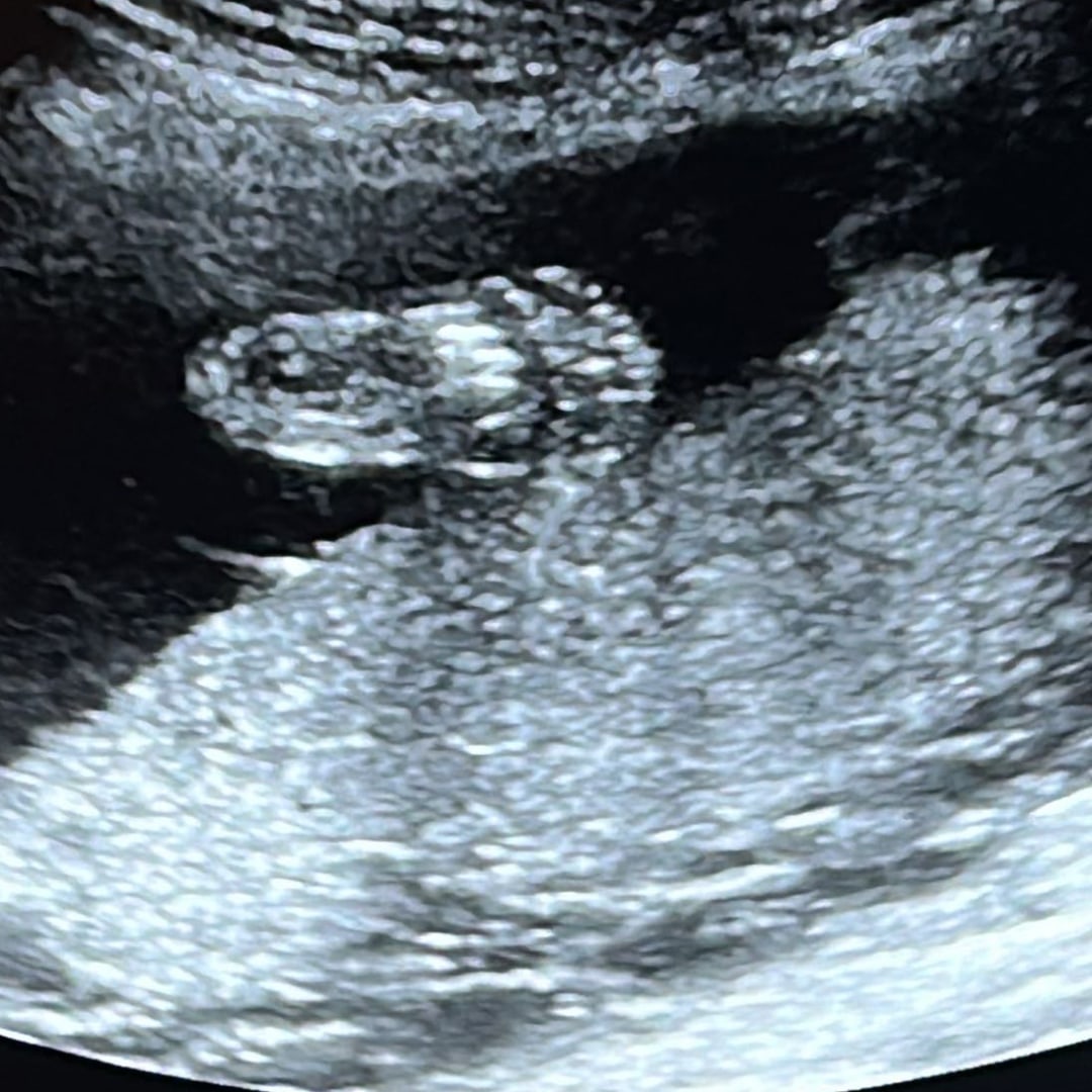 Photo shared by Corinne for their Babylist baby registry.