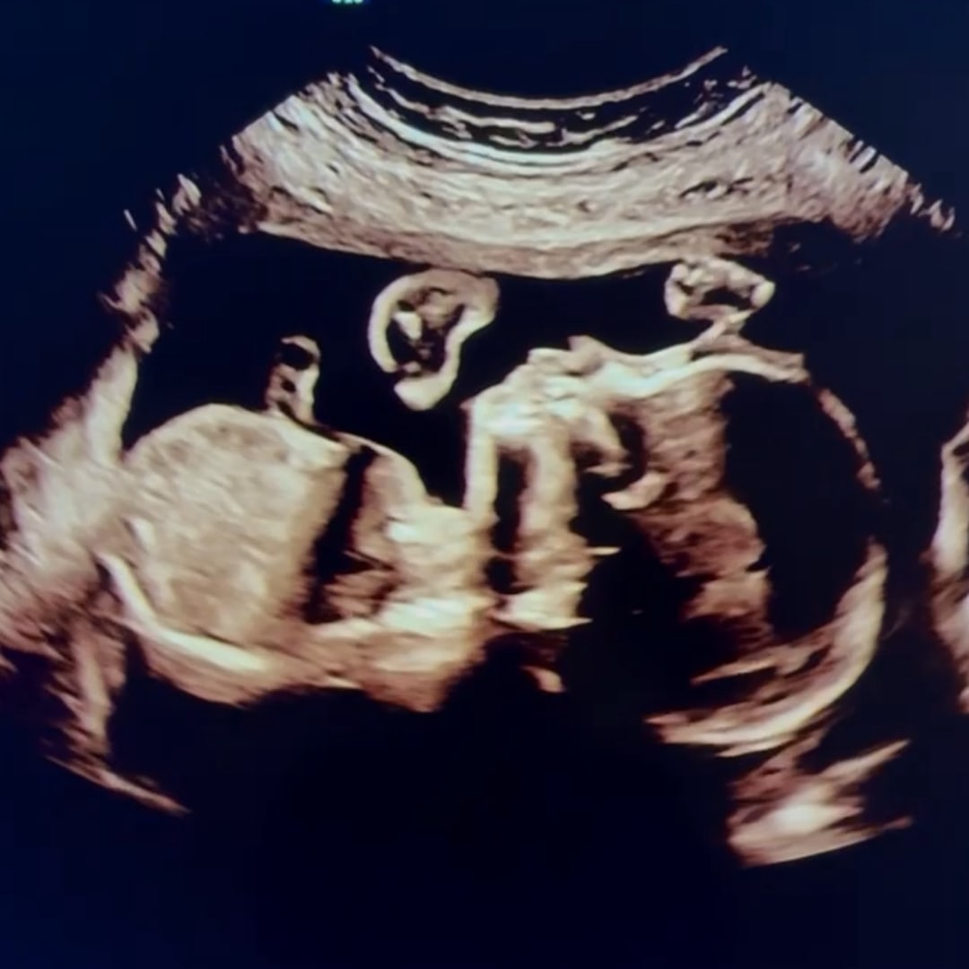 Photo shared by Celeste for their Babylist baby registry.