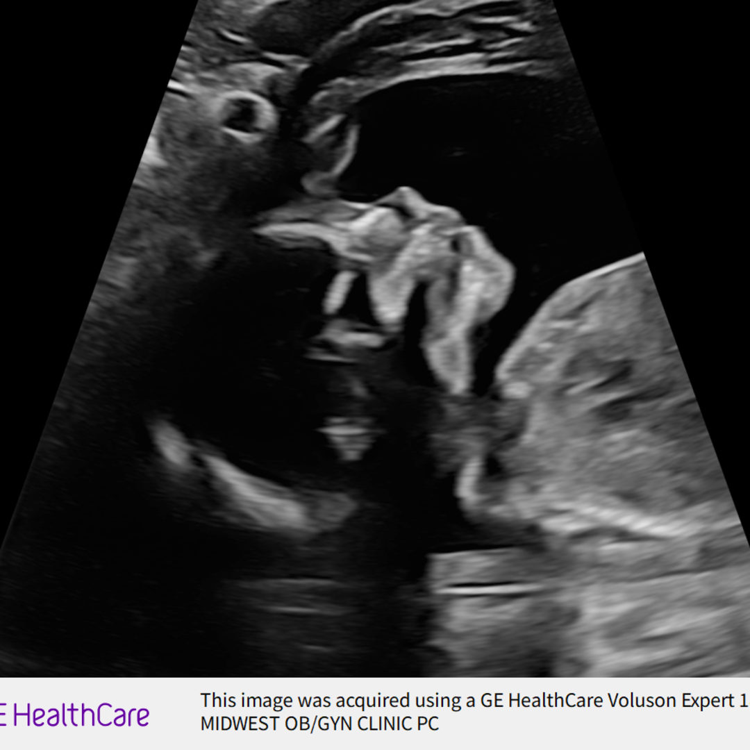 Photo shared by April for their Babylist baby registry.