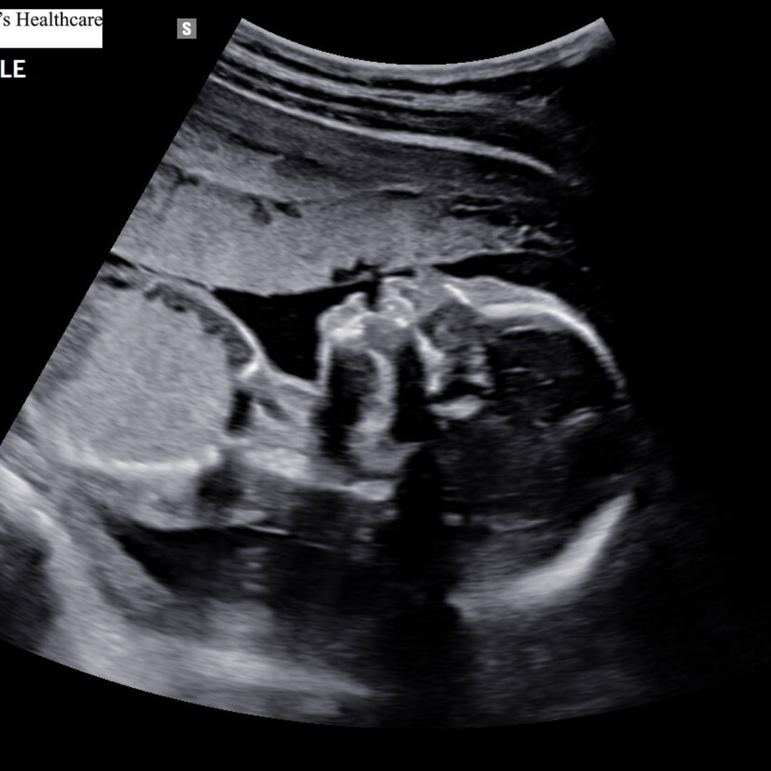 Photo shared by Destiny for their Babylist baby registry.