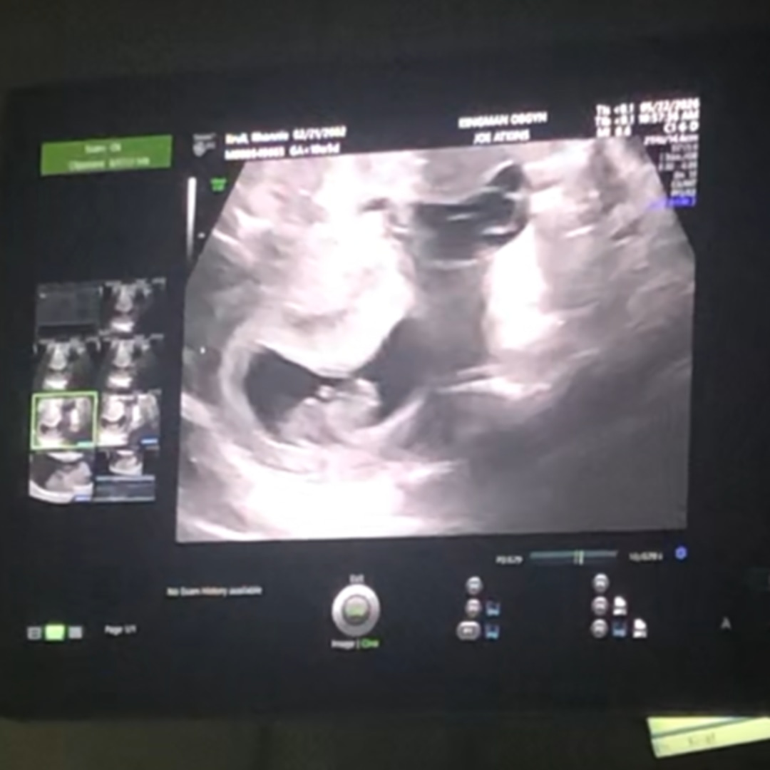 Photo shared by Rhonnie for their Babylist baby registry.