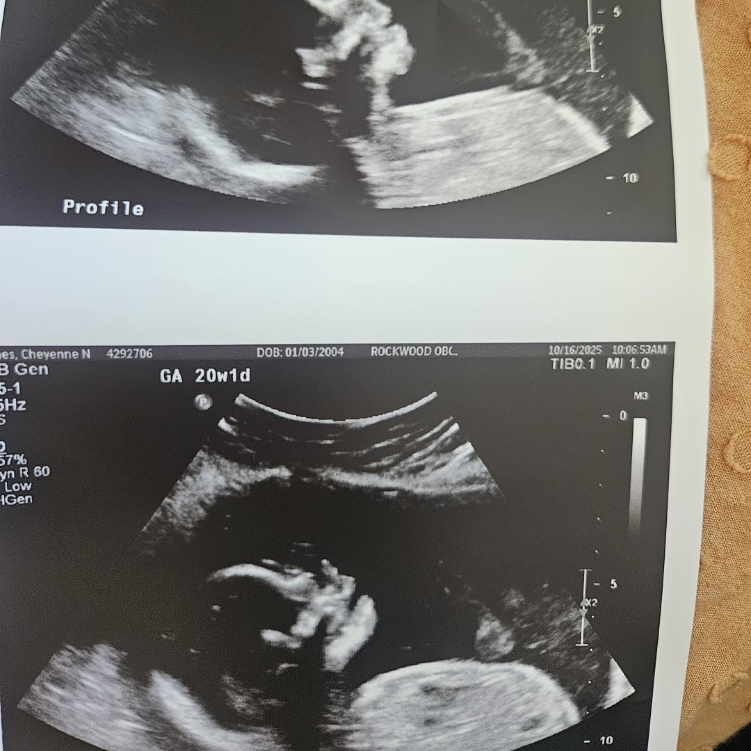 Photo shared by Cheyenne for their Babylist baby registry.