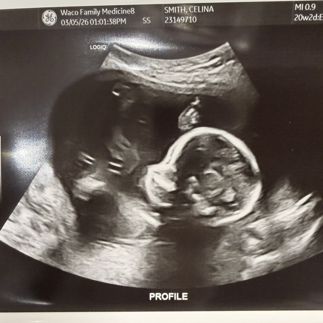 Photo shared by Celina for their Babylist baby registry.