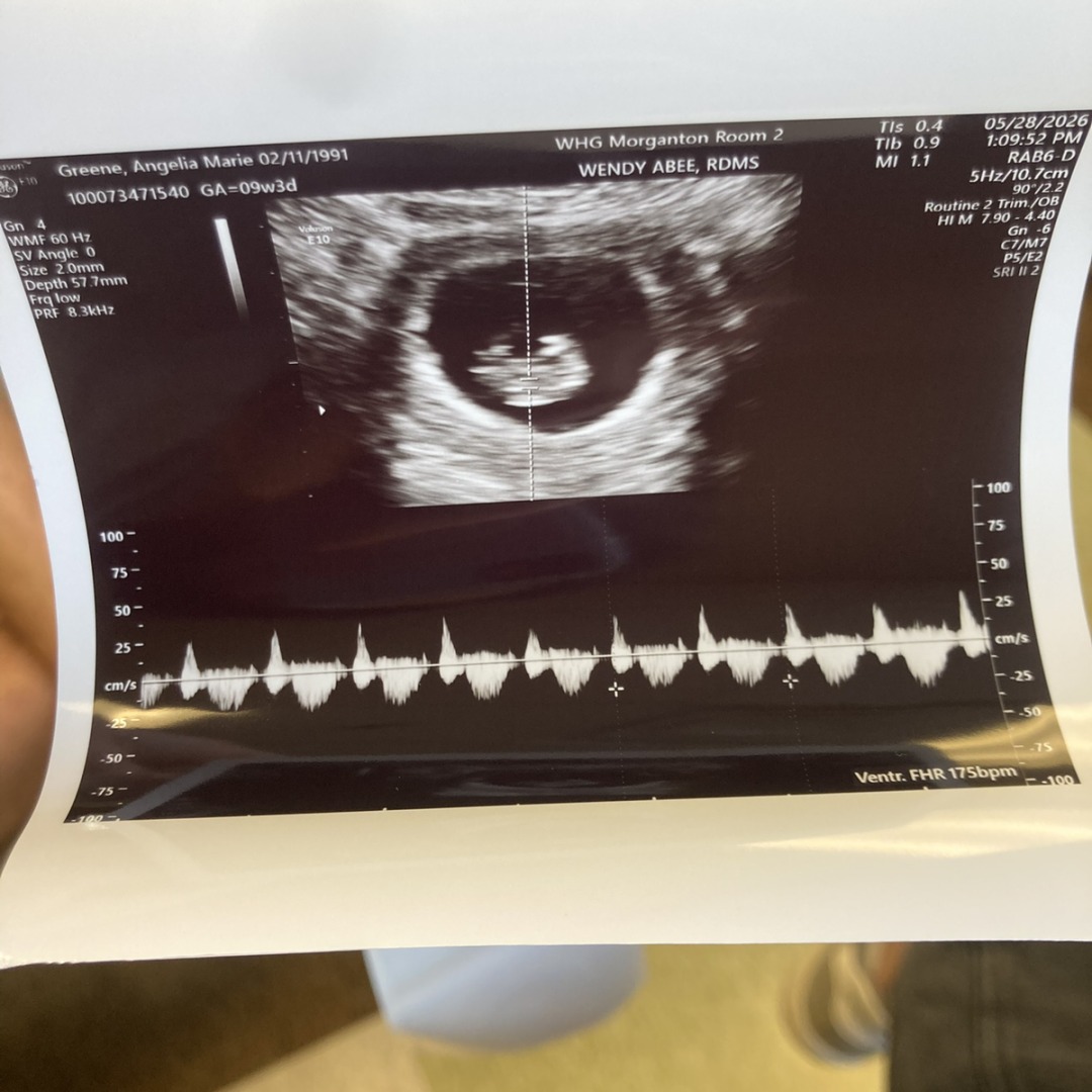 Photo shared by Angelia for their Babylist baby registry.