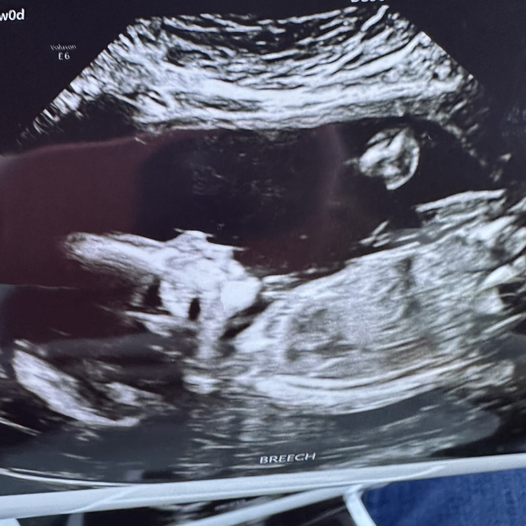 Photo shared by Baylee for their Babylist baby registry.