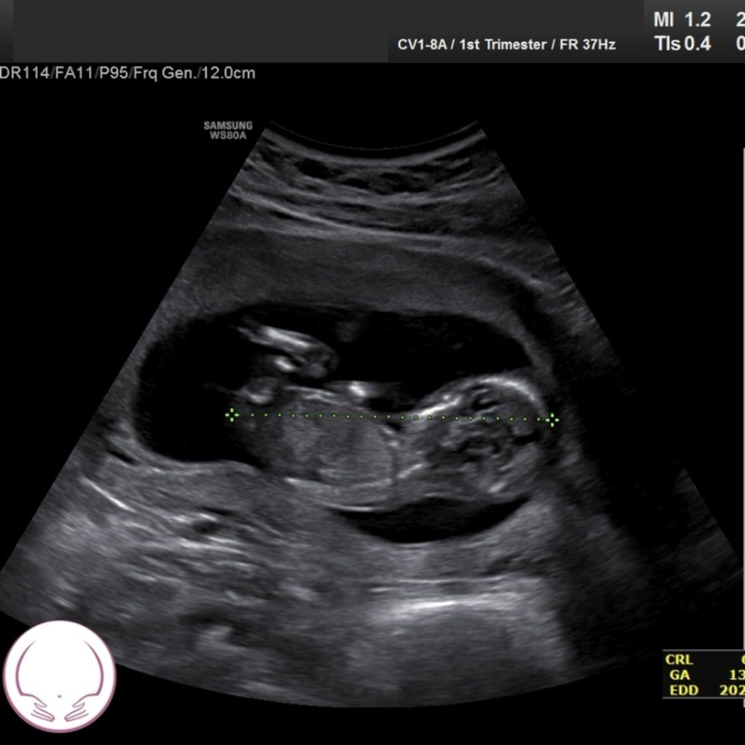 Photo shared by Rachel for their Babylist baby registry.
