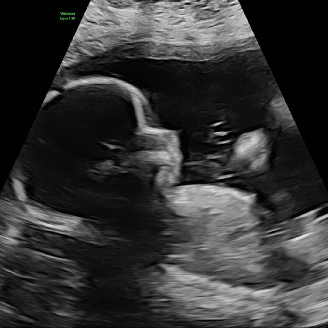 Photo shared by Jason for their Babylist baby registry.
