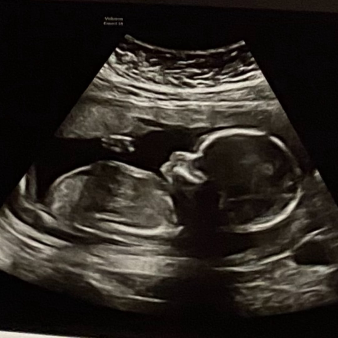 Photo shared by Emily for their Babylist baby registry.