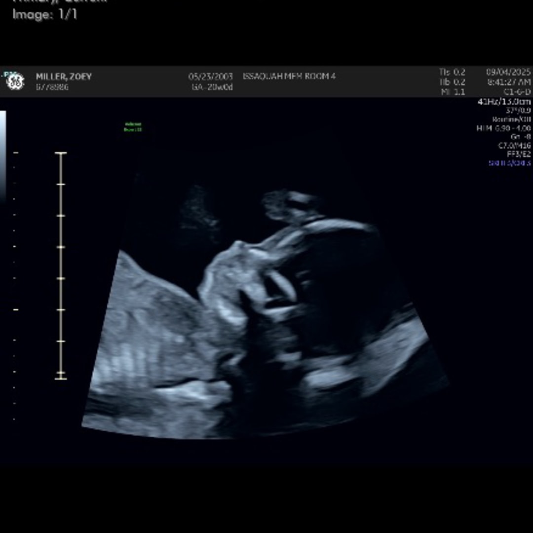 Photo shared by Zoey for their Babylist baby registry.