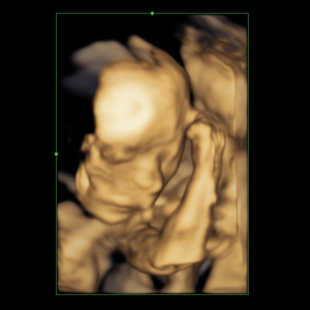 Photo shared by Cassandrah for their Babylist baby registry.