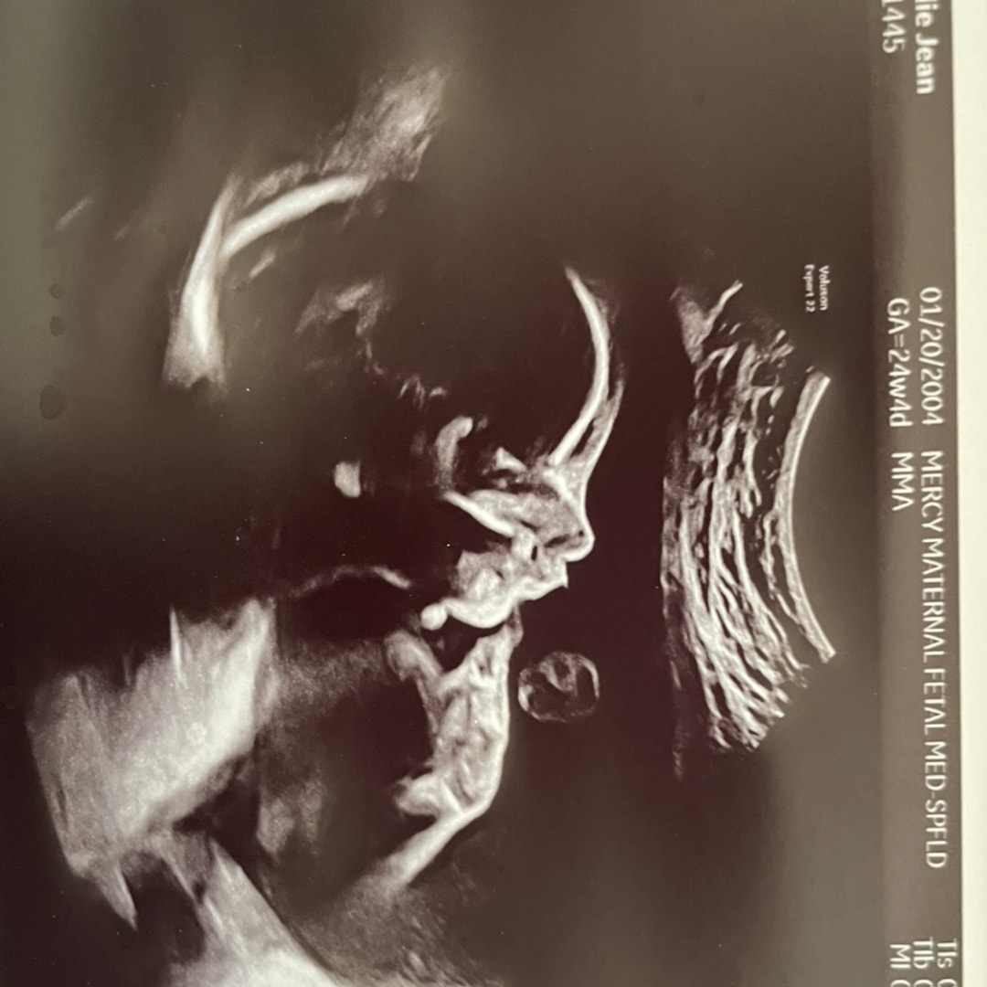 Photo shared by Callie for their Babylist baby registry.