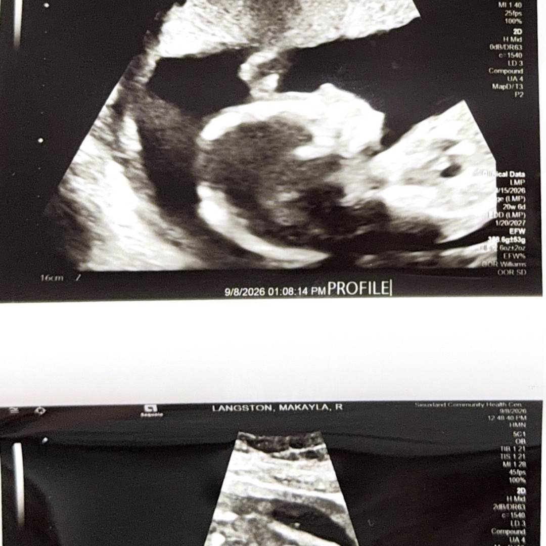 Photo shared by Makayla for their Babylist baby registry.