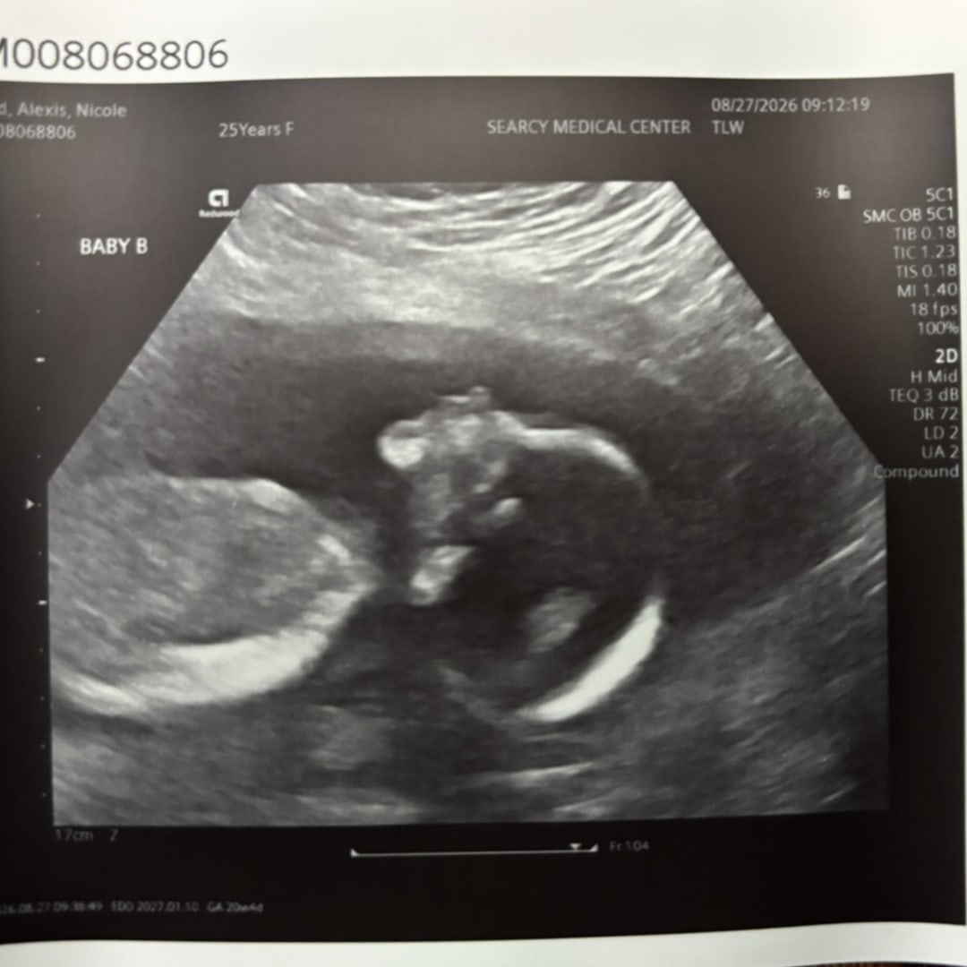 Photo shared by Alexis for their Babylist baby registry.