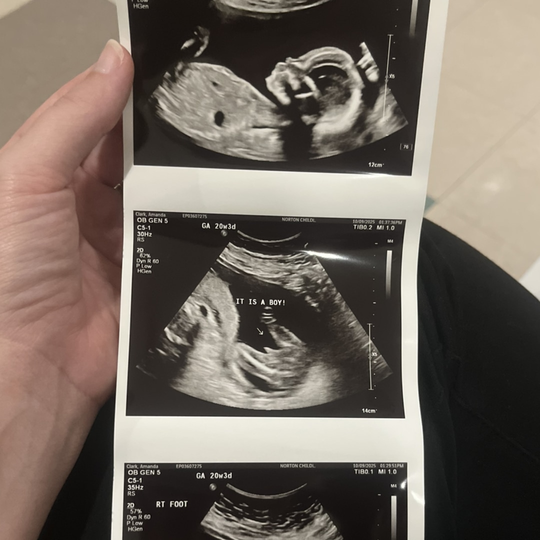 Photo shared by Amanda for their Babylist baby registry.