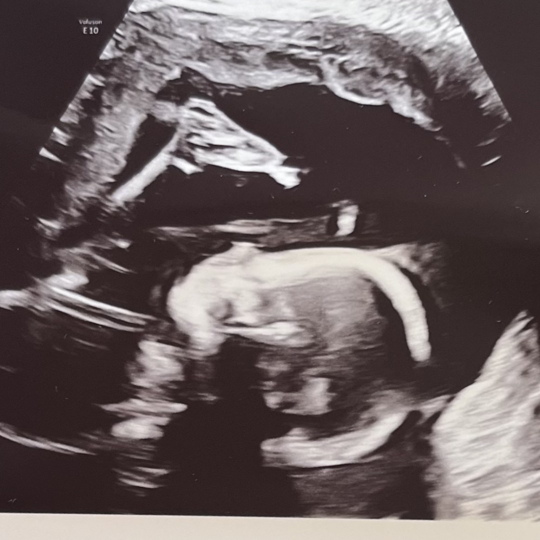 Photo shared by Morley for their Babylist baby registry.